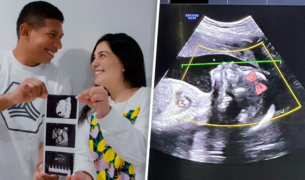 La pareja también se animó a revelar el futuro nombre de su bebé. Foto: Ana Siucho/Instagram La pareja también se animó a revelar el futuro nombre de su bebé. Foto: Ana Siucho/Instagram