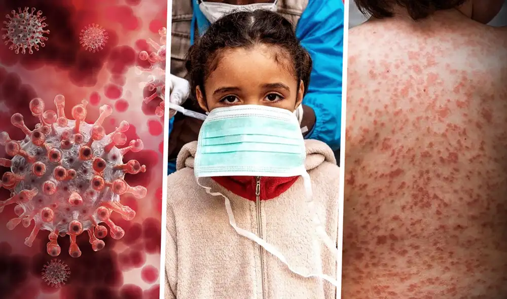 Los datos sobre niños y adolescentes que padecen COVID-19 grave y hospitalizados son pocos, pero los sectores de salud no deben descuidarse. Foto: composición Unicef / Kawasaki Disease Foundation