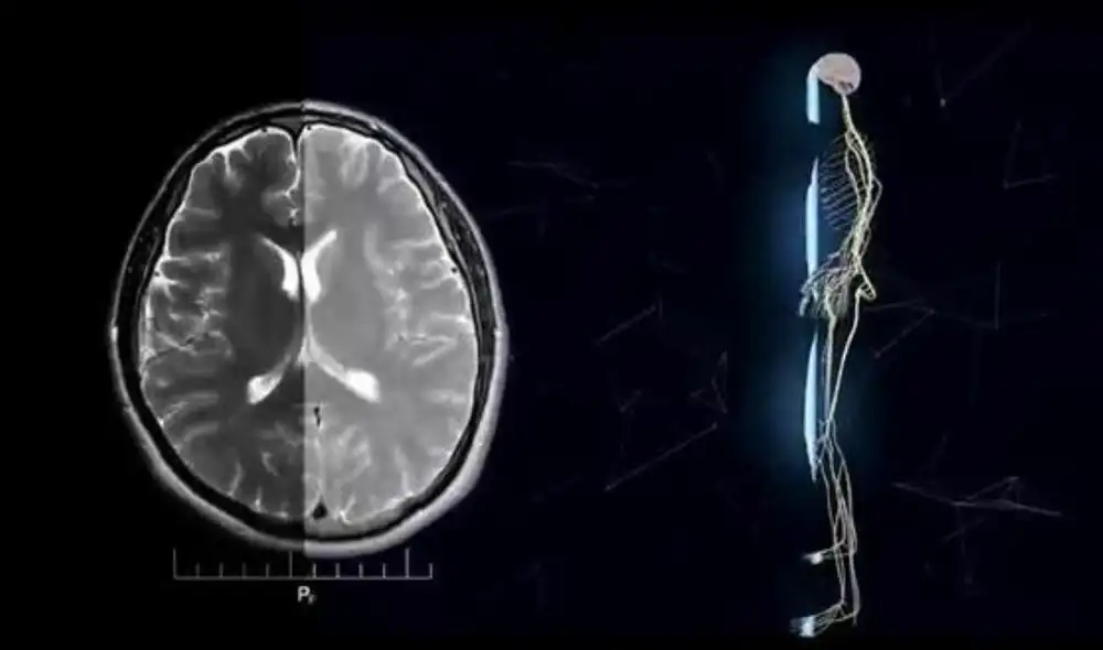 La idea de utilizar robots diminutos en el campo de la medicina está abandonando el umbral de la ficción a causa de múltiples iniciativas. Foto: captura de EFE La idea de utilizar robots diminutos en el campo de la medicina está abandonando el umbral de la ficción a causa de múltiples iniciativas. Foto: captura de EFE