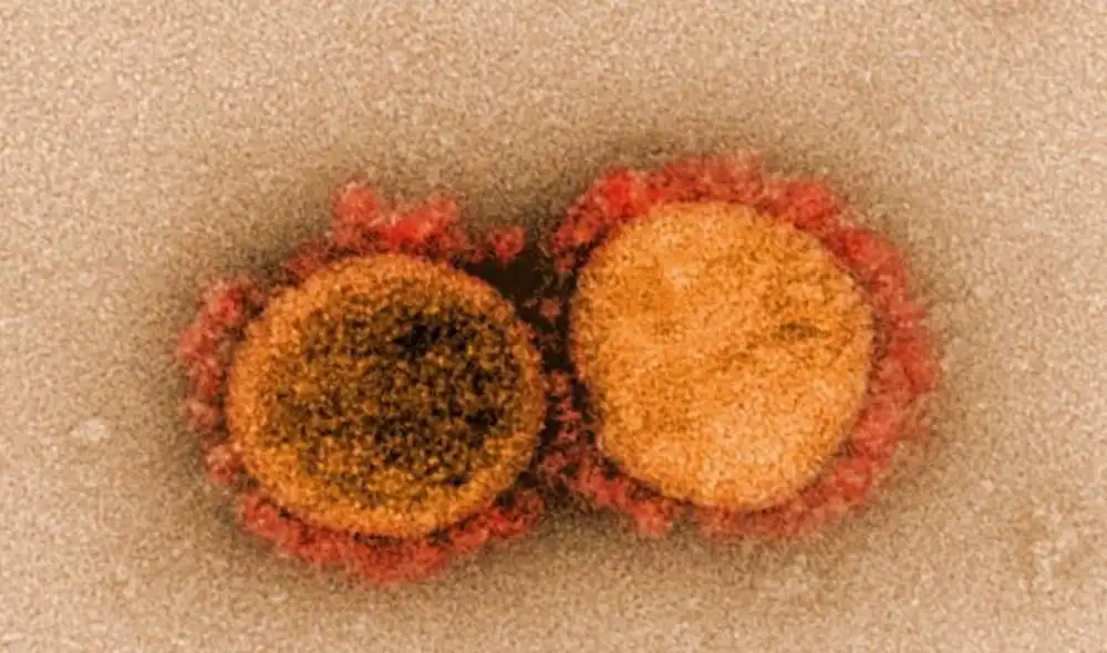 Estas son las partículas aisladas y mejoradas en color del SARS-CoV-2. Foto: NIAID