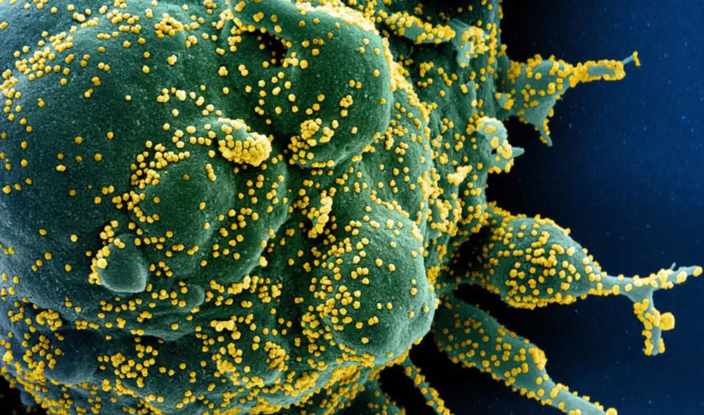 Partículas de coronavirus SARS-CoV-2 salen de una célula infectada. Foto: CDC