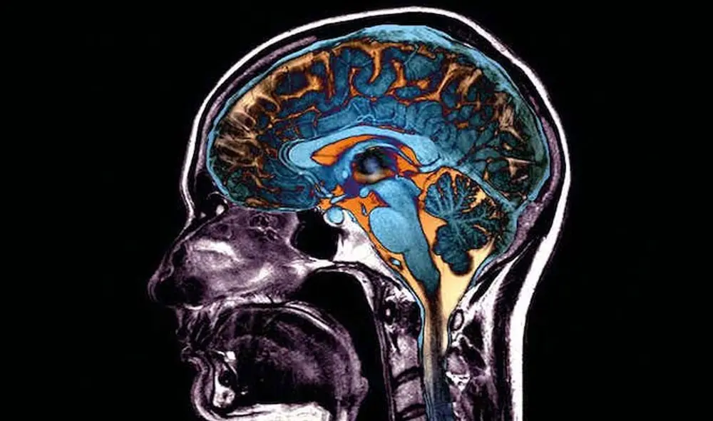 Los cerebros de fallecidos por COVID-19 presentaban daño en ciertas áreas. Foto referencial: Science Photo Library