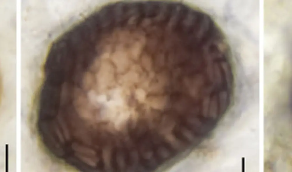 Imagen de microscopio del Bicellum Brasieri, como ha sido nombrado. Foto: Paul Strother Imagen de microscopio del Bicellum Brasieri, como ha sido nombrado. Foto: Paul Strother