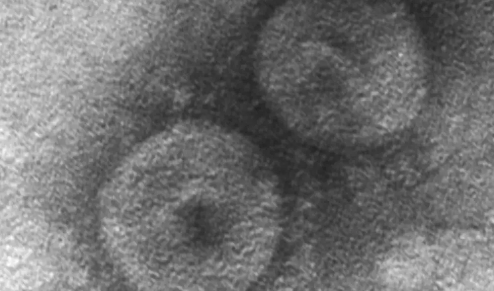 El coronavirus descubierto fue identificado como CCoV-HuPn-2018. Foto: Universidad de Ohio