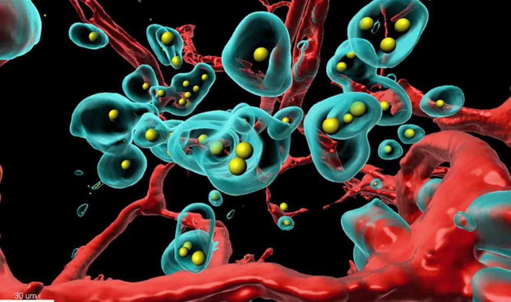 Vista del tumor desde el interior (rojo: vasos sanguíneos, turquesa: células tumorales, amarillo: anticuerpo terapéutico). Imagen: Plückthun Lab