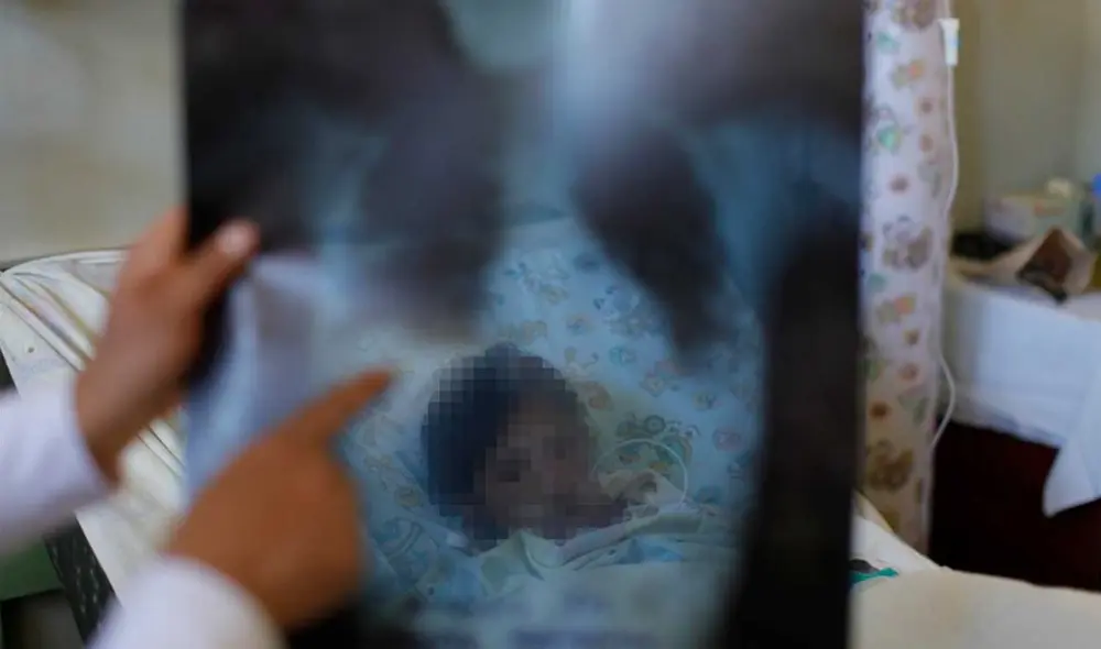 Autoridades de salud recomiendan cuidar a la población vulnerable. Foto: La República/archivo Autoridades de salud recomiendan cuidar a la población vulnerable. Foto: La República/archivo