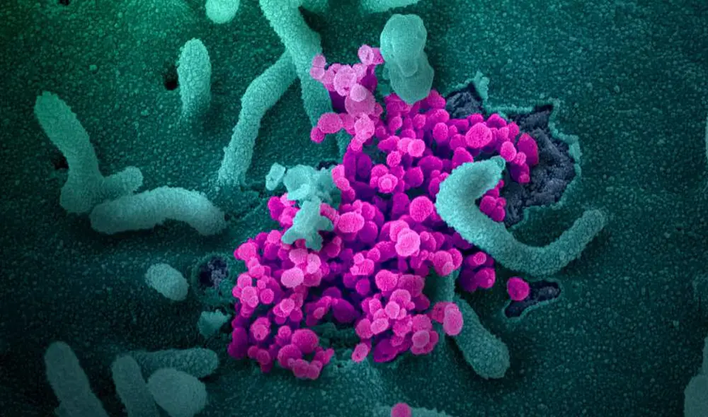 Partículas de SARS-CoV-2 emergen de una célula infectada después de haberse multiplicado. Foto: NIAiD