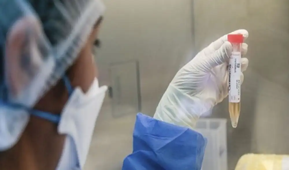 INS continuará con los estudios de vigilancia epidemiológica. Foto: Andina INS continuará con los estudios de vigilancia epidemiológica. Foto: Andina