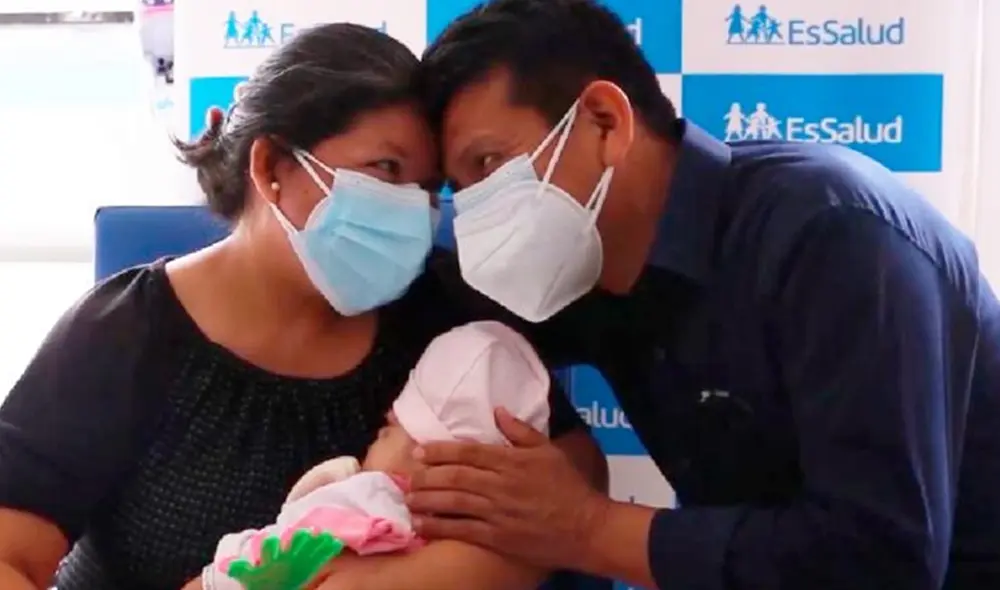 Lucero había nacido con el Síndrome de Crouzon. Foto: EsSalud