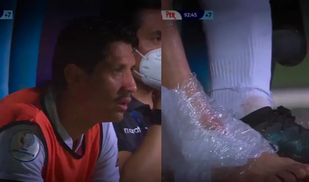 Imagen del tobillo de Gianluca Lapadula tras salir del campo de juego. Foto: captura América TV