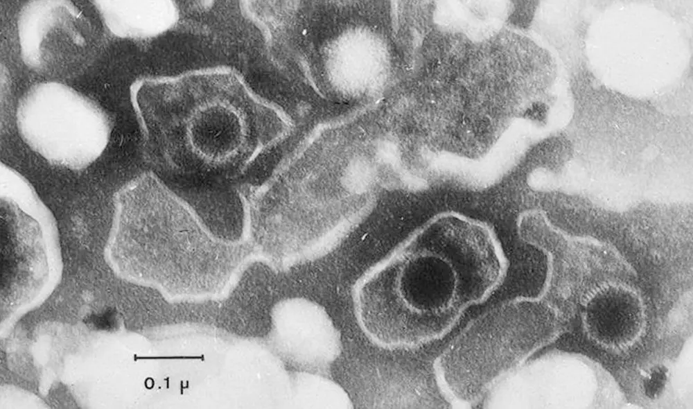 Imagen de microscopio electrónico muestra tres partículas del virus de Epstein-Barr (VEB), cuya estructura es circular. Foto: Liza Gross