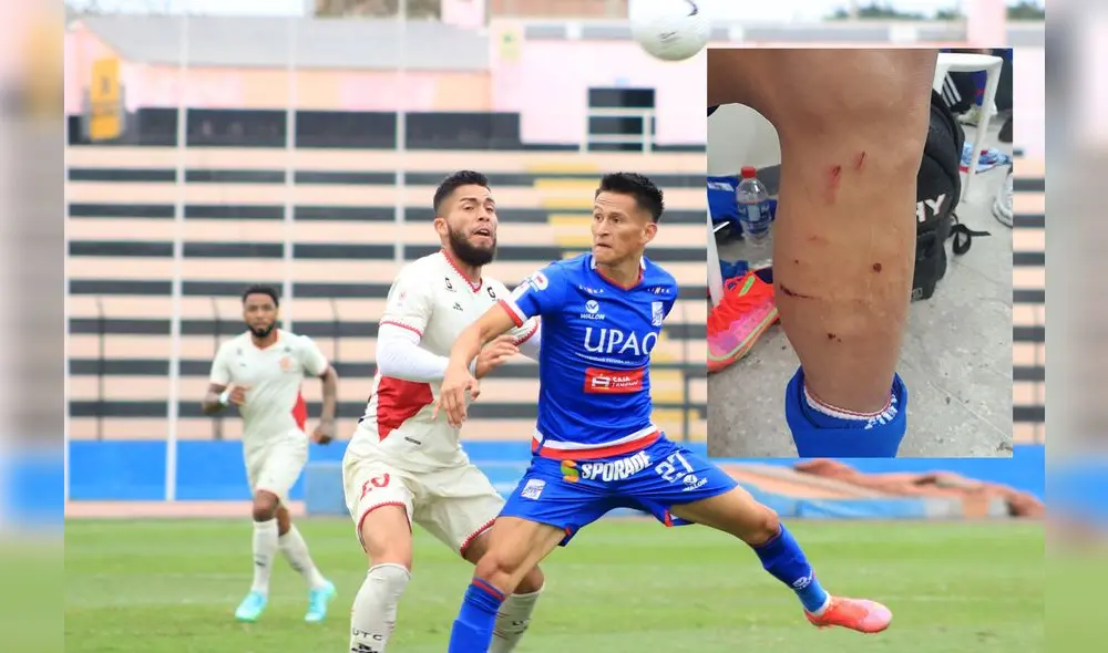 Relly Fernández estará ausente en el cuadro Tricolor. Foto: FPF