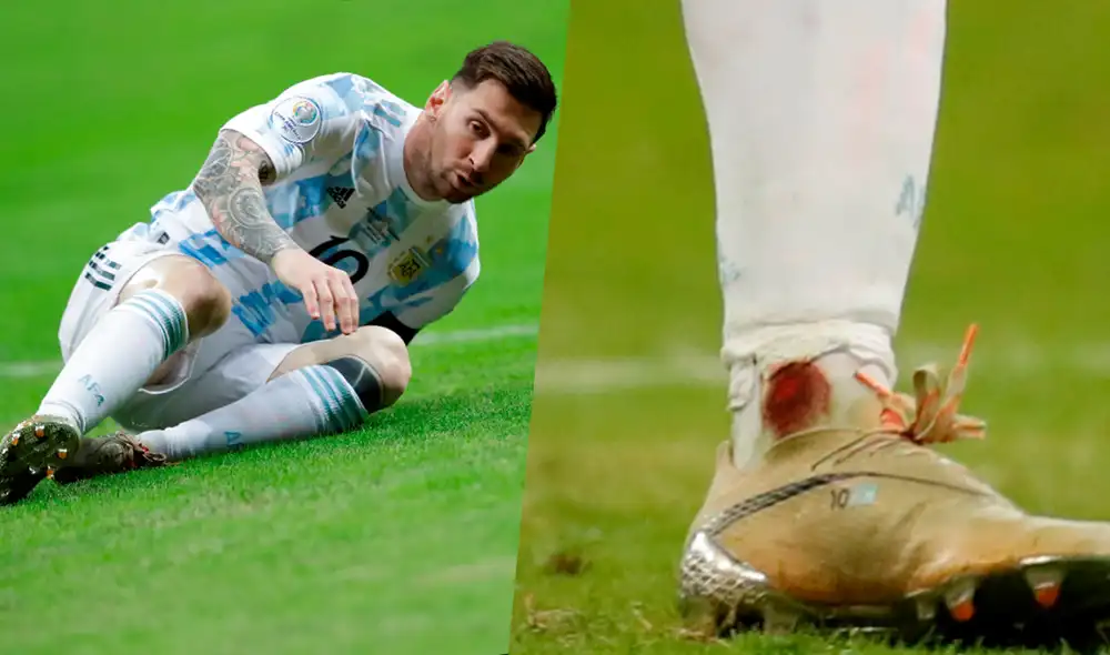 Así quedó el tobillo de Lionel Messi tras el encuentro ante Colombia. Foto: Composición LR / EFE