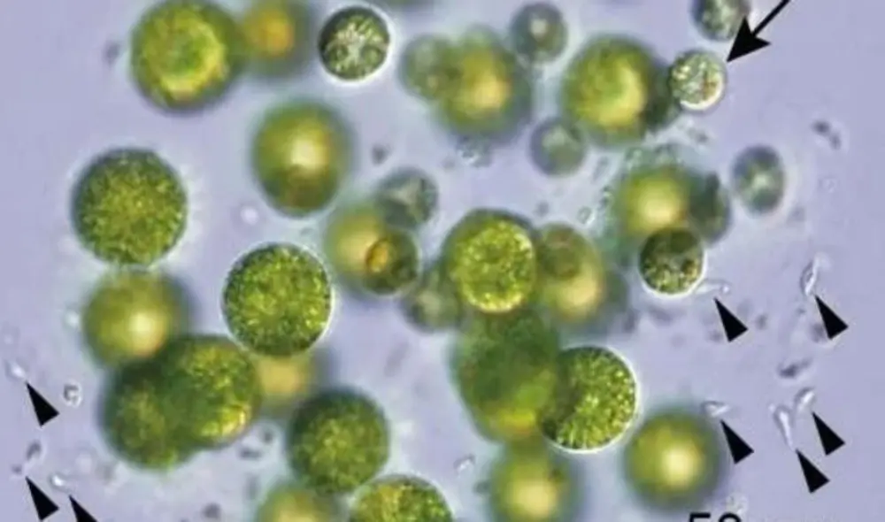 Colonia de Pleodorina starrii bisexual, un tipo de alga verde. Foto: Kohei Takahashi