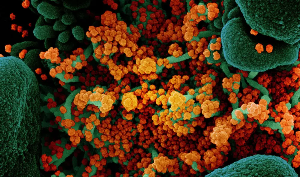 Imagen captada con microscopio electrónico muestra miles de partículas de SARS-CoV-2 saliendo de una célula infectada. Foto: NIAID