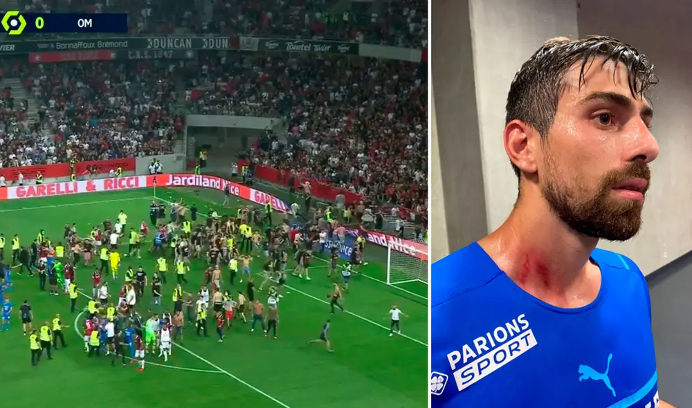 El partido fue suspendido cuando el Niza ganaba 1-0 a Marsella. Foto: composición La República El partido fue suspendido cuando el Niza ganaba 1-0 a Marsella. Foto: composición La República