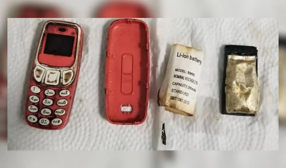 La vida del sujeto pudo verse comprometida si no se retiraba el aparato a tiempo. Foto: Skender Teljaku/Facebook