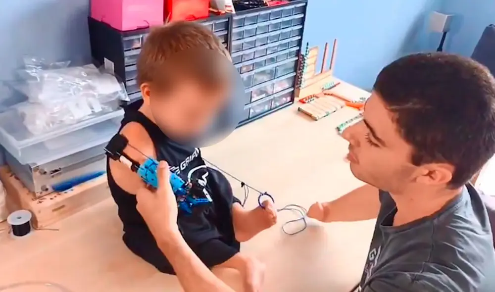 El youtuber pudo elaborar la prótesis en 15 minutos. Foto: captura de Twitter El youtuber pudo elaborar la prótesis en 15 minutos. Foto: captura de Twitter