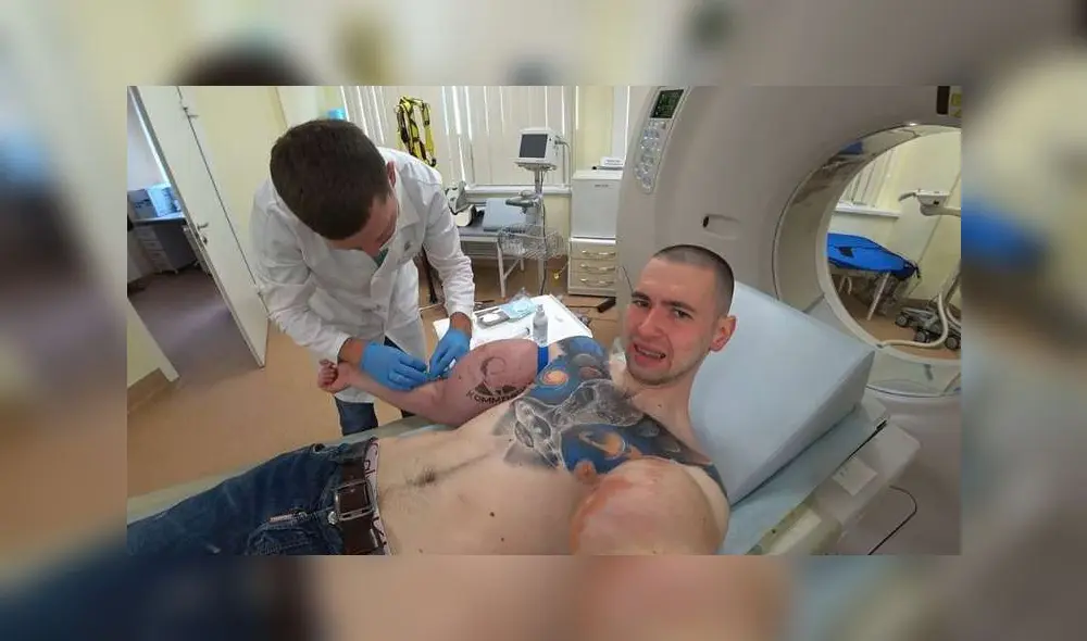 El joven empezó a inyectarse en los brazos a los 20 años. Hoy tiene 25 y sufre las consecuencias de tener aceite en su organismo. Foto: ruki_bazuki_official/Instagram El joven empezó a inyectarse en los brazos a los 20 años. Hoy tiene 25 y sufre las consecuencias de tener aceite en su organismo. Foto: ruki_bazuki_official/Instagram