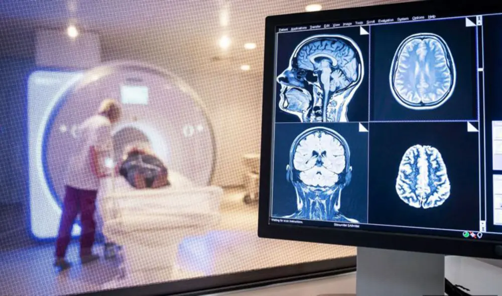 Las secuelas de la COVID-19 también repercuten en el cerebro. Foto: referencial / Science Photo Library