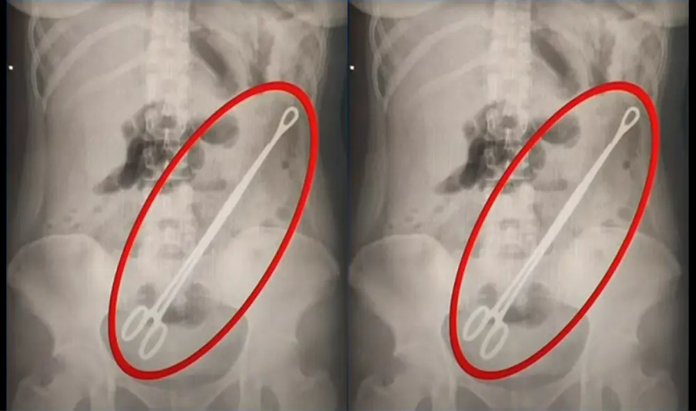 El director del hospital admitió la responsabilidad de la negligencia y pidió disculpas públicamente. Foto: Todo Noticias Argentina