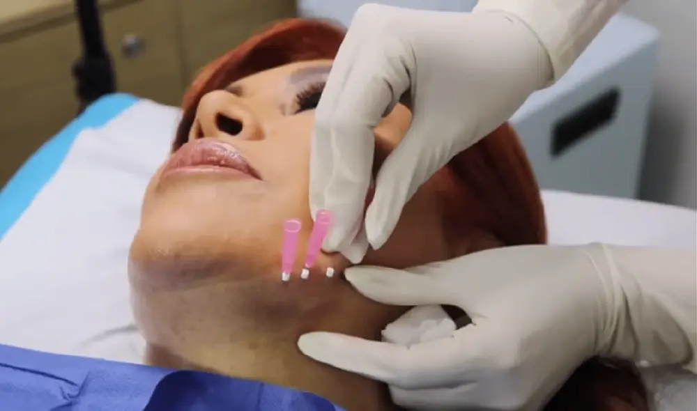 Magaly Medina entrevistó a la doctora Ruth Guerra para que le expliqué en qué consistía el tratamiento de hilos tensores. Foto: YouTube / Magaly Medina Magaly Medina entrevistó a la doctora Ruth Guerra para que le expliqué en qué consistía el tratamiento de hilos tensores. Foto: YouTube / Magaly Medina