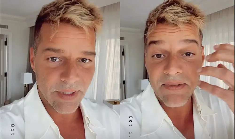 Ricky Martin consideró que tal vez no debió dar la entrevista con el rostro inflamado para no preocupar a su fans. Foto: Ricky Martin / Instagram