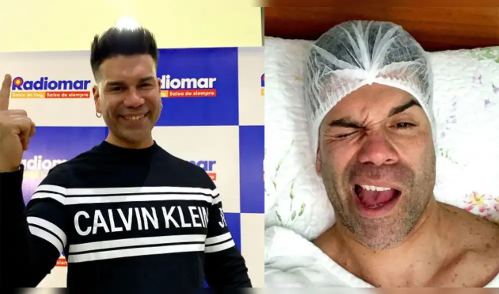 Carlos Barraza reveló que no se hizo ningún retoque estético. Foto: Carlos Barraza/Instagram Carlos Barraza reveló que no se hizo ningún retoque estético. Foto: Carlos Barraza/Instagram