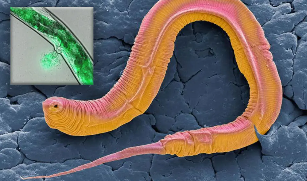 El gusano redondo C. elegans se destruye a sí mismo para transferir nutrientes a su descendencia. Foto: Science Photo Library/Alamy / UCL