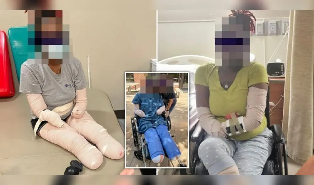 El Dr. Wesley Ely publicó imágenes de su paciente que perdió las manos y los pies. Foto: Wesley Ely/Twitter