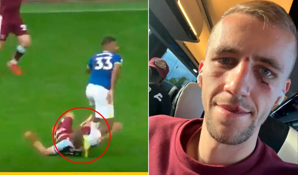 Tomáš Souček tuvo que ser atendido por el cuerpo médico de West Ham. Foto: composición GLR Tomáš Souček tuvo que ser atendido por el cuerpo médico de West Ham. Foto: composición GLR