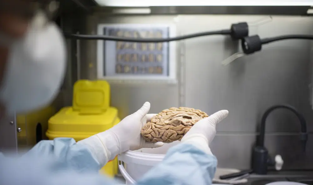 Un investigador sostiene uno de los cerebros del banco de la fundación Cien. Foto: El País