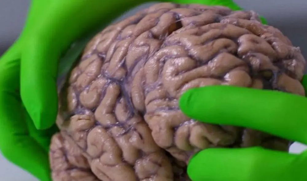 El cerebro humano ha ido cambiando de tamaño conforme pasan los siglos. Foto: BBC El cerebro humano ha ido cambiando de tamaño conforme pasan los siglos. Foto: BBC