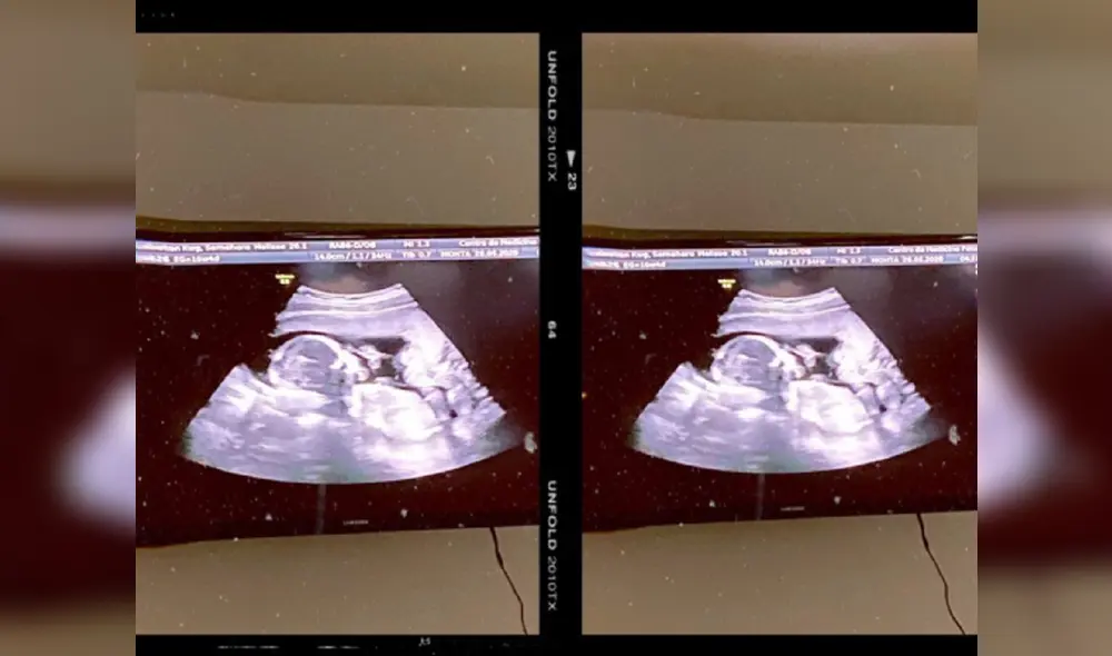 Las parejas finalmente cambiaron de bebés, dice la demanda. Foto: AFP Las parejas finalmente cambiaron de bebés, dice la demanda. Foto: AFP