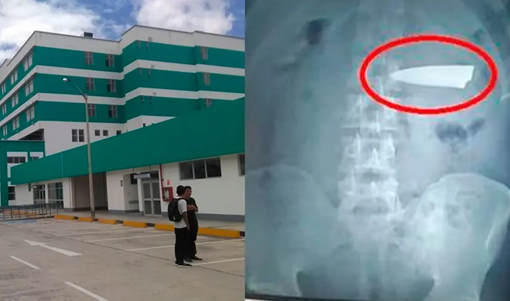 El Hospital de Moyobamba iniciará un proceso de auditoría para determinar el grado de responsabilidad del cuerpo médico. Foto: captura de ATV