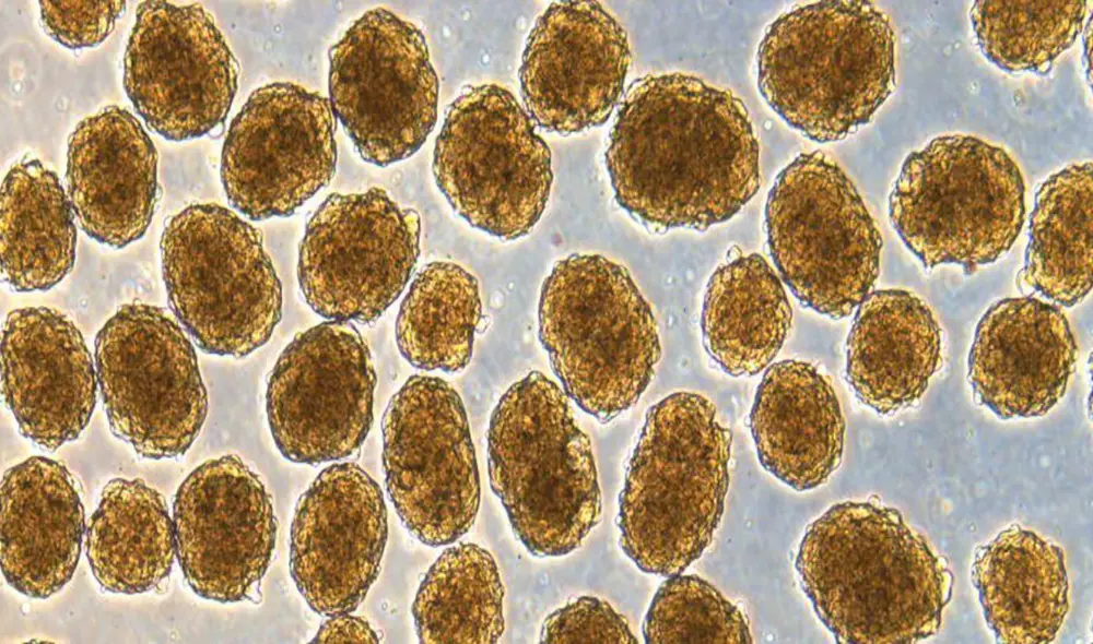 Células beta secretoras de insulina humana bajo el microscopio. Foto: Laboratorio Millman