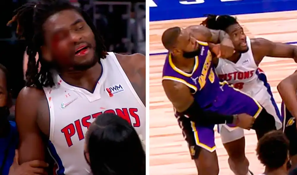 Tras la agresión, Isaiah Stewart terminó sangrando a la altura de su ojo derecho. Foto: captura de Sports Center Tras la agresión, Isaiah Stewart terminó sangrando a la altura de su ojo derecho. Foto: captura de Sports Center