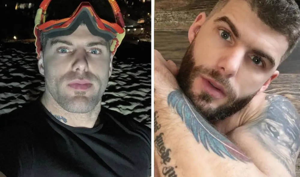 Greg Michel necesitaría una segunda operación. Foto: Instagram