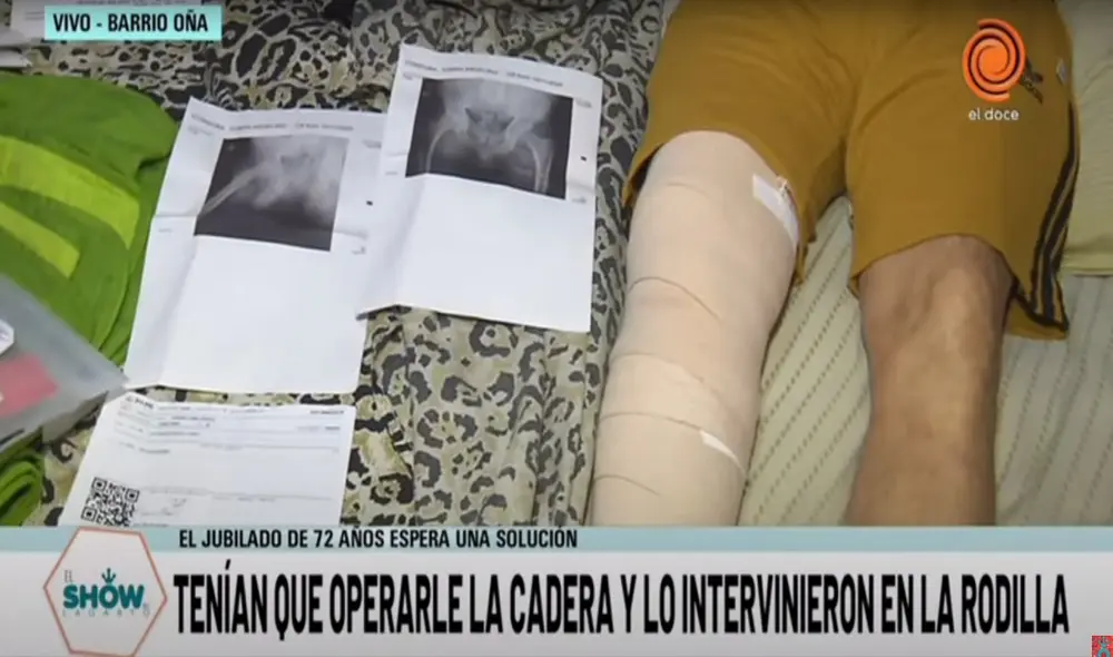 En Argentina no han dudado en calificarlo como un caso inaudito. Foto: captura de LagartoShowOk / YouTube En Argentina no han dudado en calificarlo como un caso inaudito. Foto: captura de LagartoShowOk / YouTube