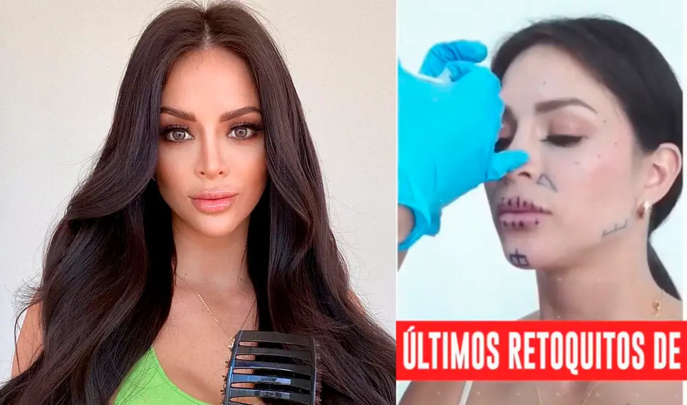 Sheyla Rojas habló del último tratamiento estético que se hizo en el rostro. Foto: Instagram / América TV Sheyla Rojas habló del último tratamiento estético que se hizo en el rostro. Foto: Instagram / América TV