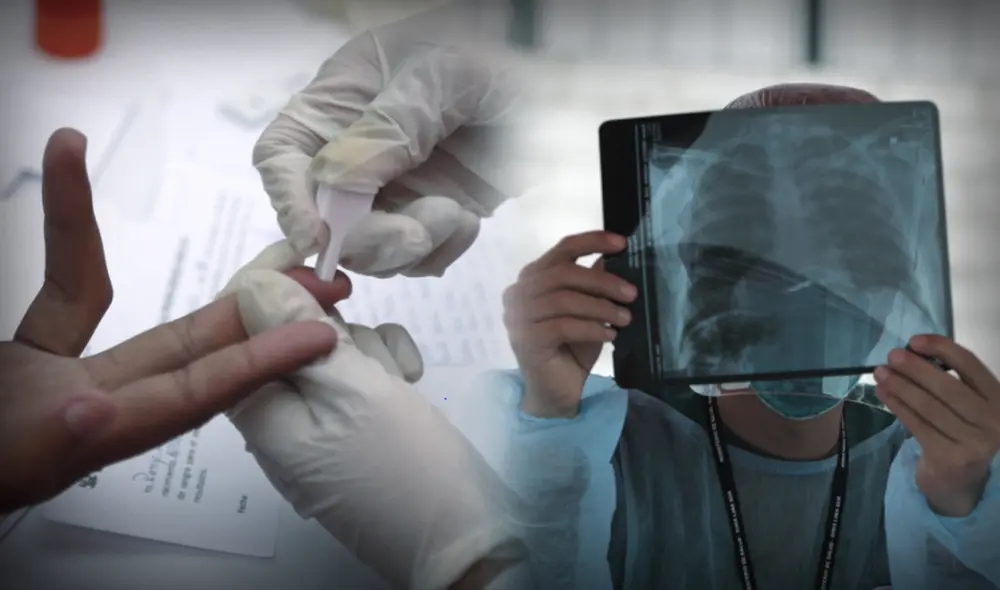 Alerta. Asociaciones también denuncian cambio de medicamentos a pacientes con VIH ante la falta de insumos. Foto: Composición La República / Jazmín Ceras Alerta. Asociaciones también denuncian cambio de medicamentos a pacientes con VIH ante la falta de insumos. Foto: Composición La República / Jazmín Ceras