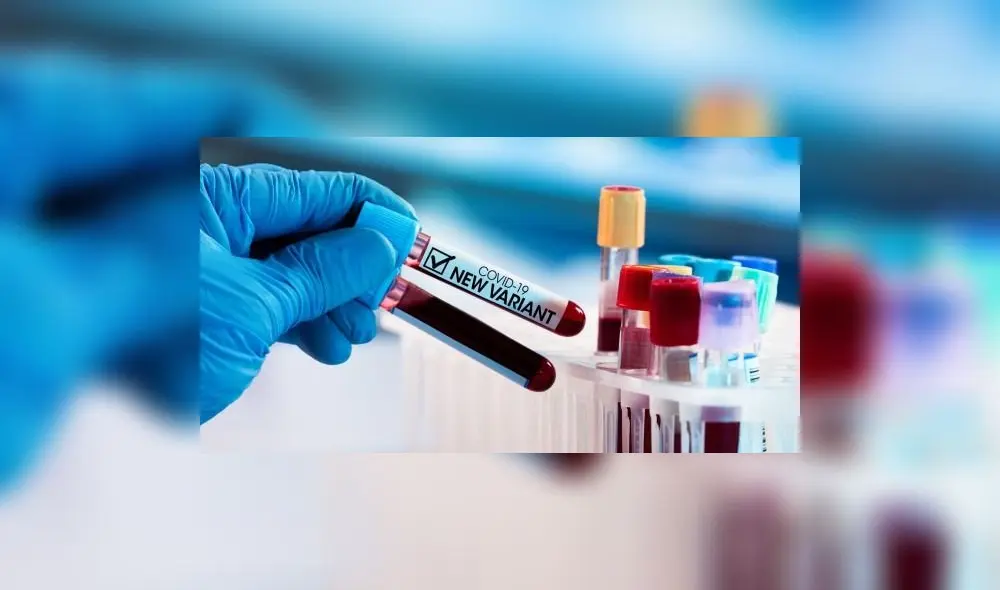 Se trata de un joven de 22 años que vive en el distrito de San Jerónimo. Se encuentra estable y en proceso de recuperación sin mayores complicaciones. Foto: Geresa Cusco Se trata de un joven de 22 años que vive en el distrito de San Jerónimo. Se encuentra estable y en proceso de recuperación sin mayores complicaciones. Foto: Geresa Cusco