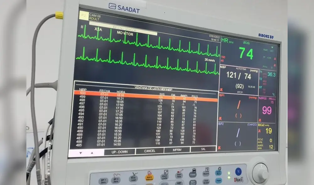 Adulta mayor requiere intervención. Foto: Elena Zamudio Adulta mayor requiere intervención. Foto: Elena Zamudio