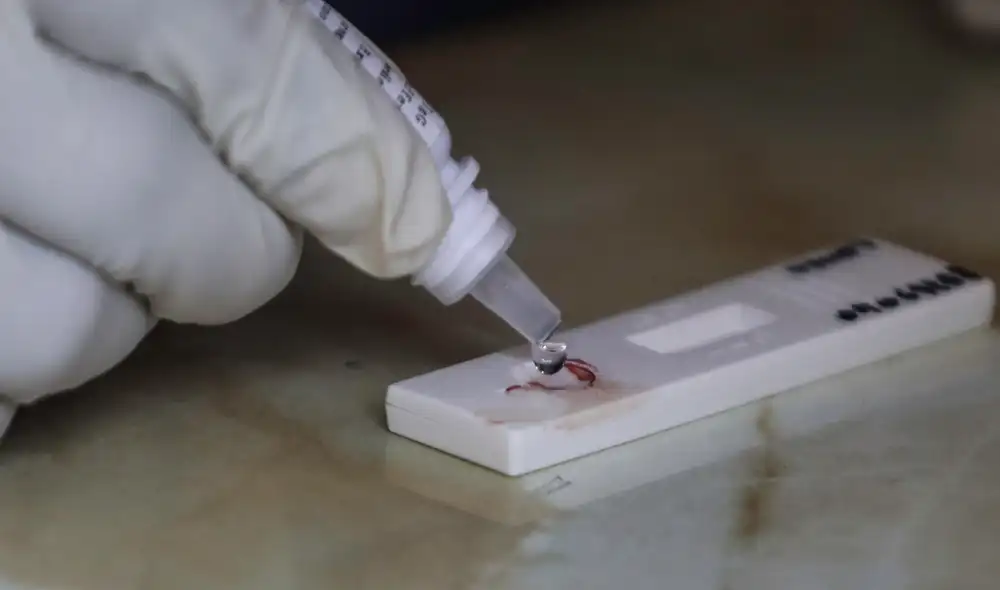 Los autotest COVID-19 se venden en el ámbito nacional, aclara el ministro de Salud. Foto: La República