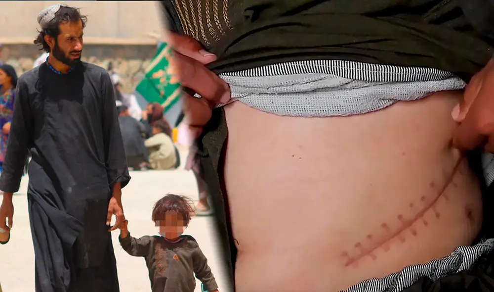 Muchas personas de escasos recursos venden sus riñones en Afganistán. Foto: composición/DW-Unicef