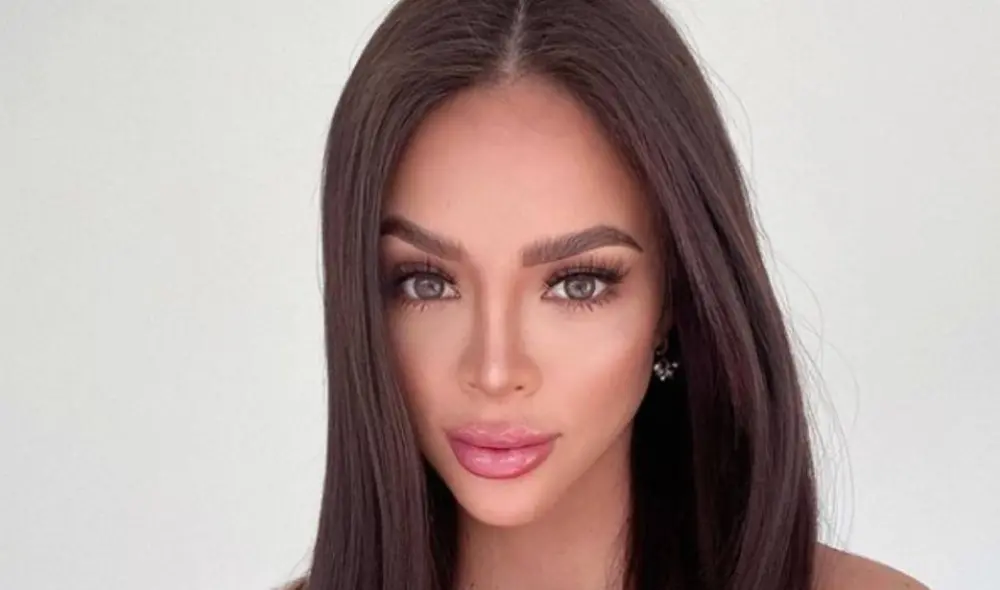 Sheyla Rojas contó que tuvo una reacción alérgica a un medicamento. Foto: Instagram