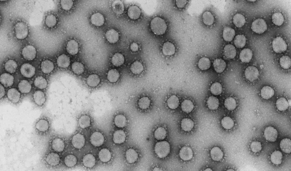 El monitoreo de nuevos virus, como el coronavirus SARS-CoV-2, es una tarea constante para prepararse ante una futura pandemia. Foto: NCB - CSIS