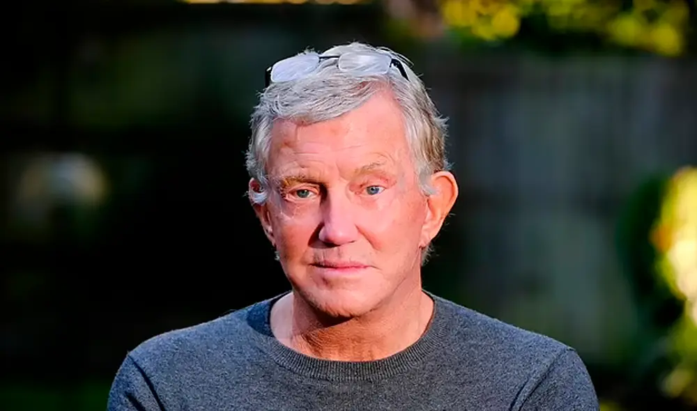 Pete usa gotas ocho veces al día para evitar que se sequen. Foto: SWNS/Pete Broadhurst