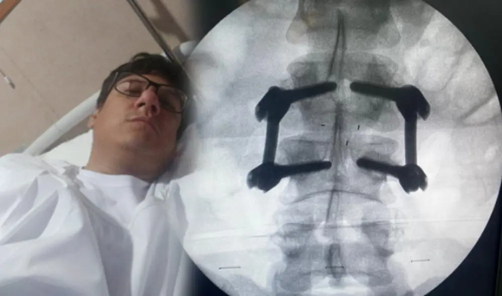 Agraviado pide apoyo a las autoridades para lograr ser indemnizados. Foto: La República