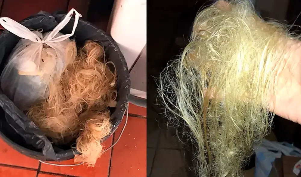 Así quedó el cabello de la adolescente. Foto: La Nación Así quedó el cabello de la adolescente. Foto: La Nación